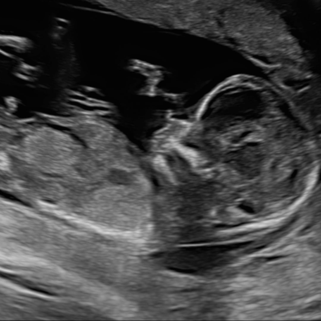 Photo shared by Krystal for their Babylist baby registry.