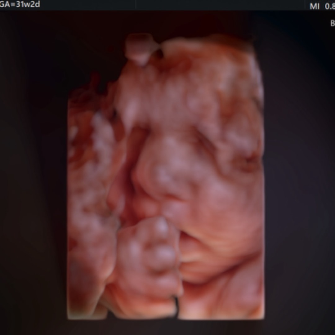 Photo shared by Grace for their Babylist baby registry.