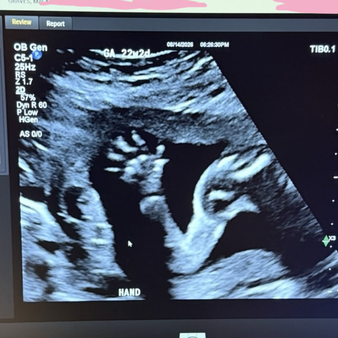 Photo shared by Kenzie for their Babylist baby registry.