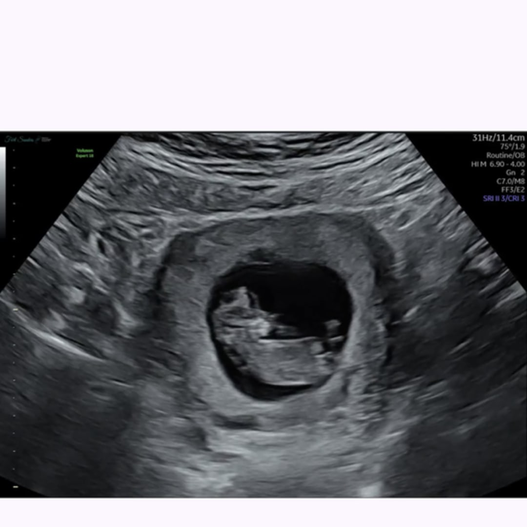 Photo shared by Haley for their Babylist baby registry.