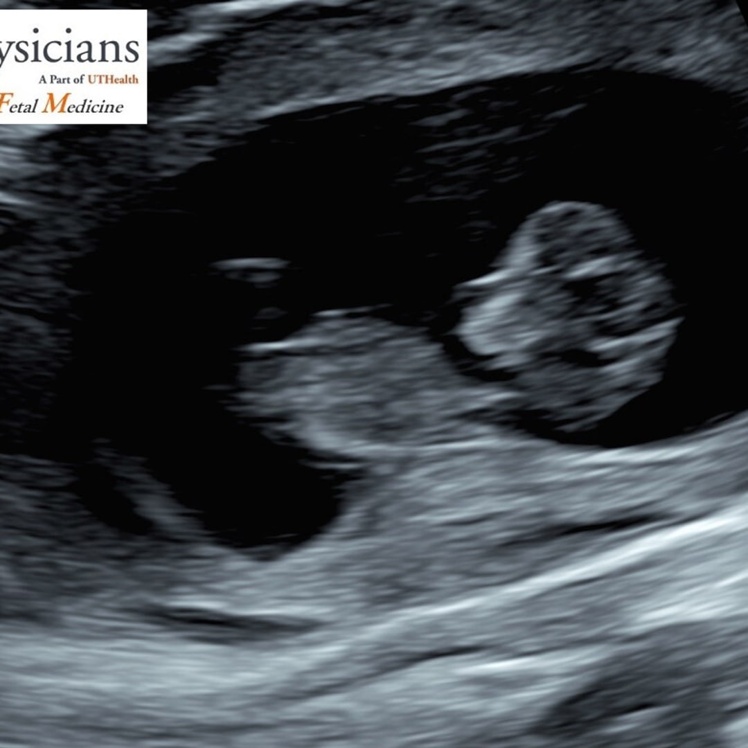 Photo shared by Arinda for their Babylist baby registry.