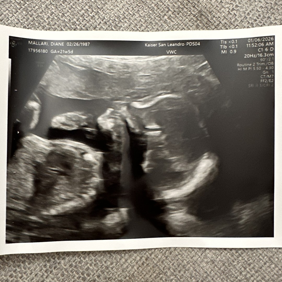 Photo shared by Diane for their Babylist baby registry.