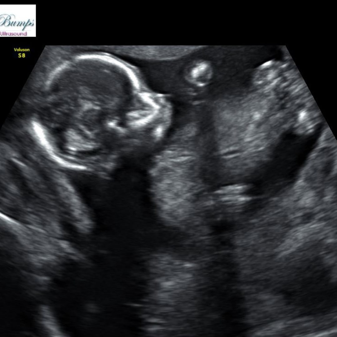 Photo shared by Kameron for their Babylist baby registry.