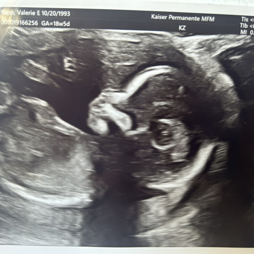 Photo shared by Valerie for their Babylist baby registry.