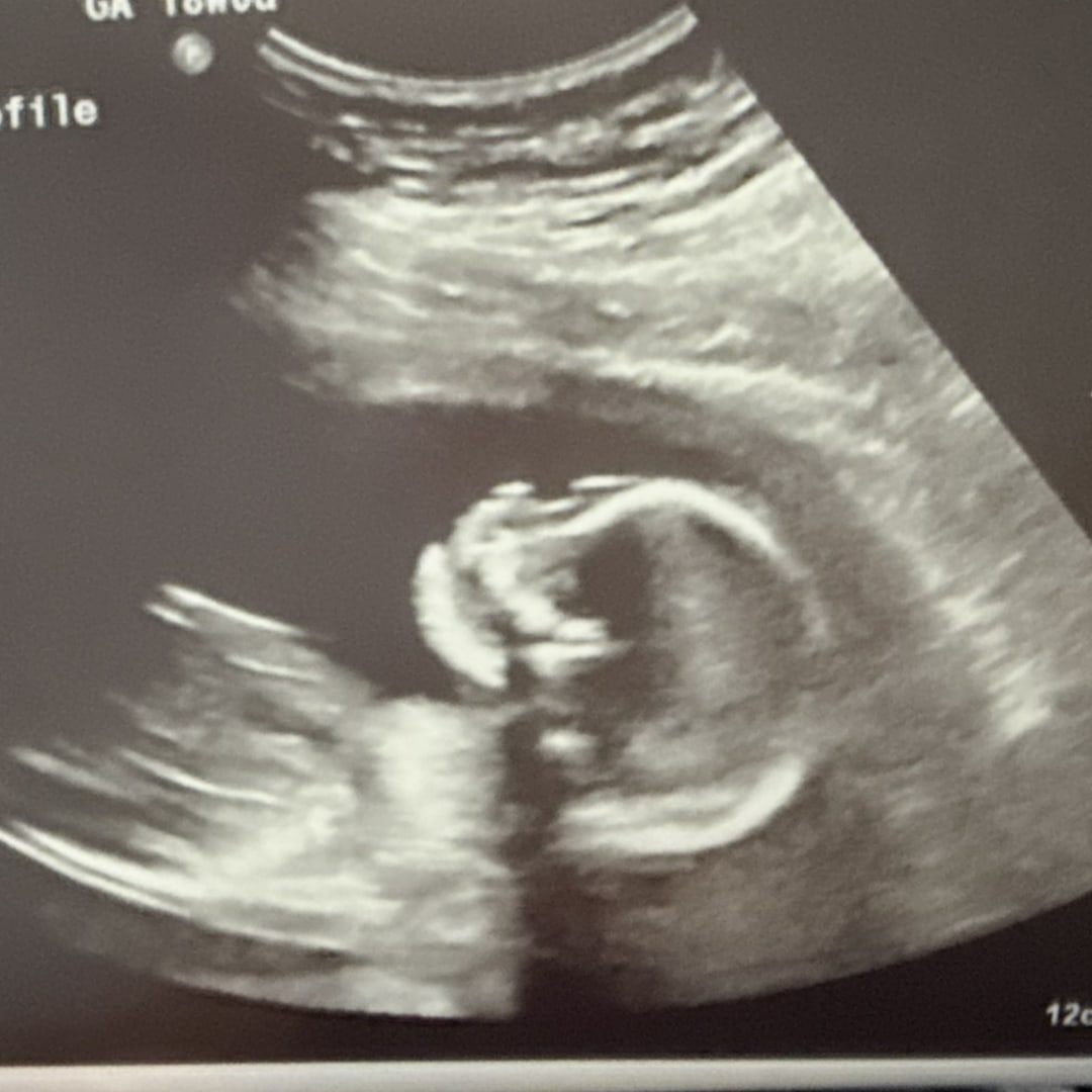 Photo shared by Sarah for their Babylist baby registry.