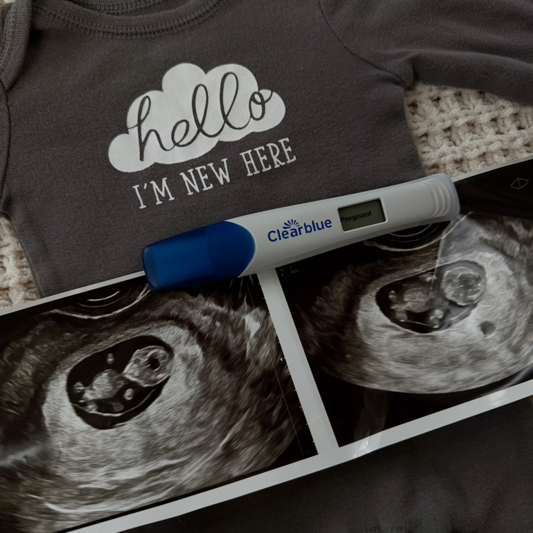 Photo shared by Grace for their Babylist baby registry.
