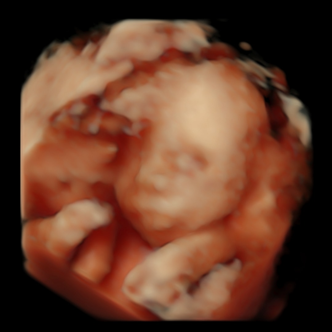 Photo shared by Lillian for their Babylist baby registry.