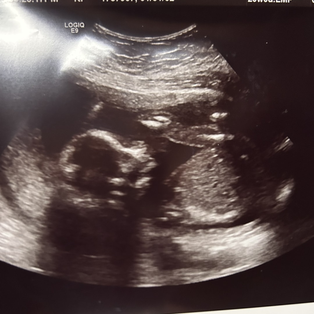 Photo shared by Faith for their Babylist baby registry.