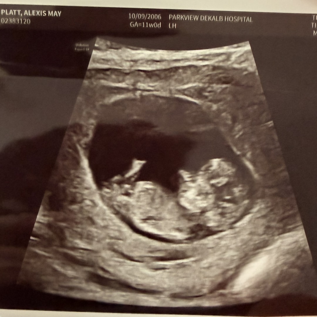 Photo shared by Alexis for their Babylist baby registry.