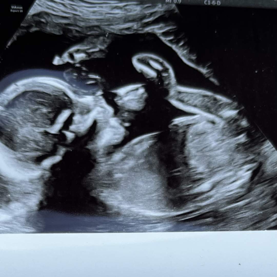 Photo shared by Shelby for their Babylist baby registry.