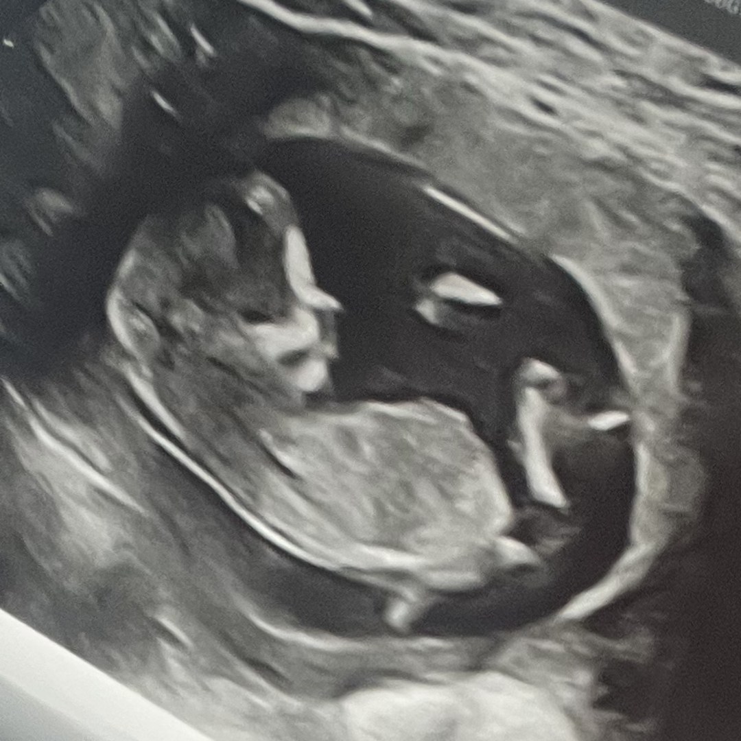 Photo shared by Drew for their Babylist baby registry.
