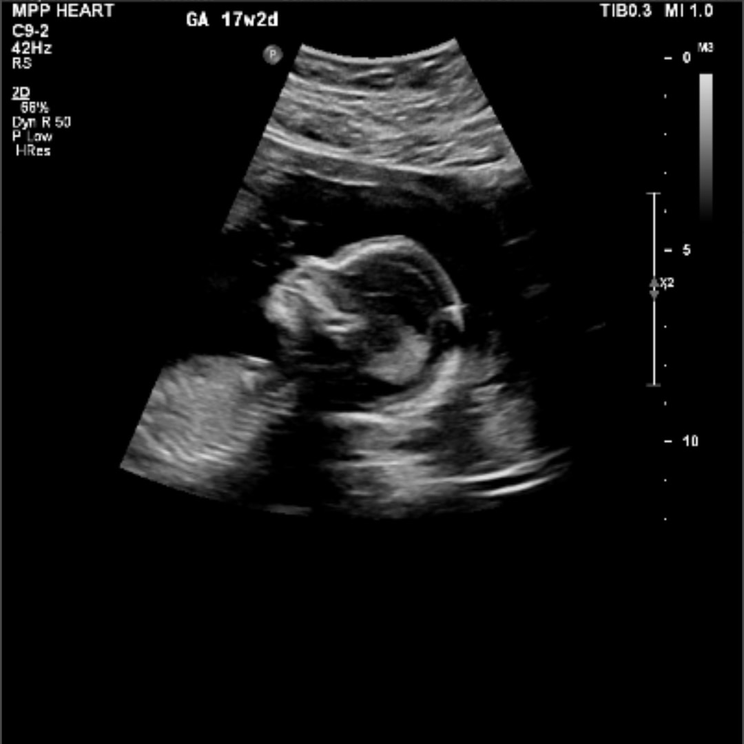 Photo shared by Jasmyn for their Babylist baby registry.