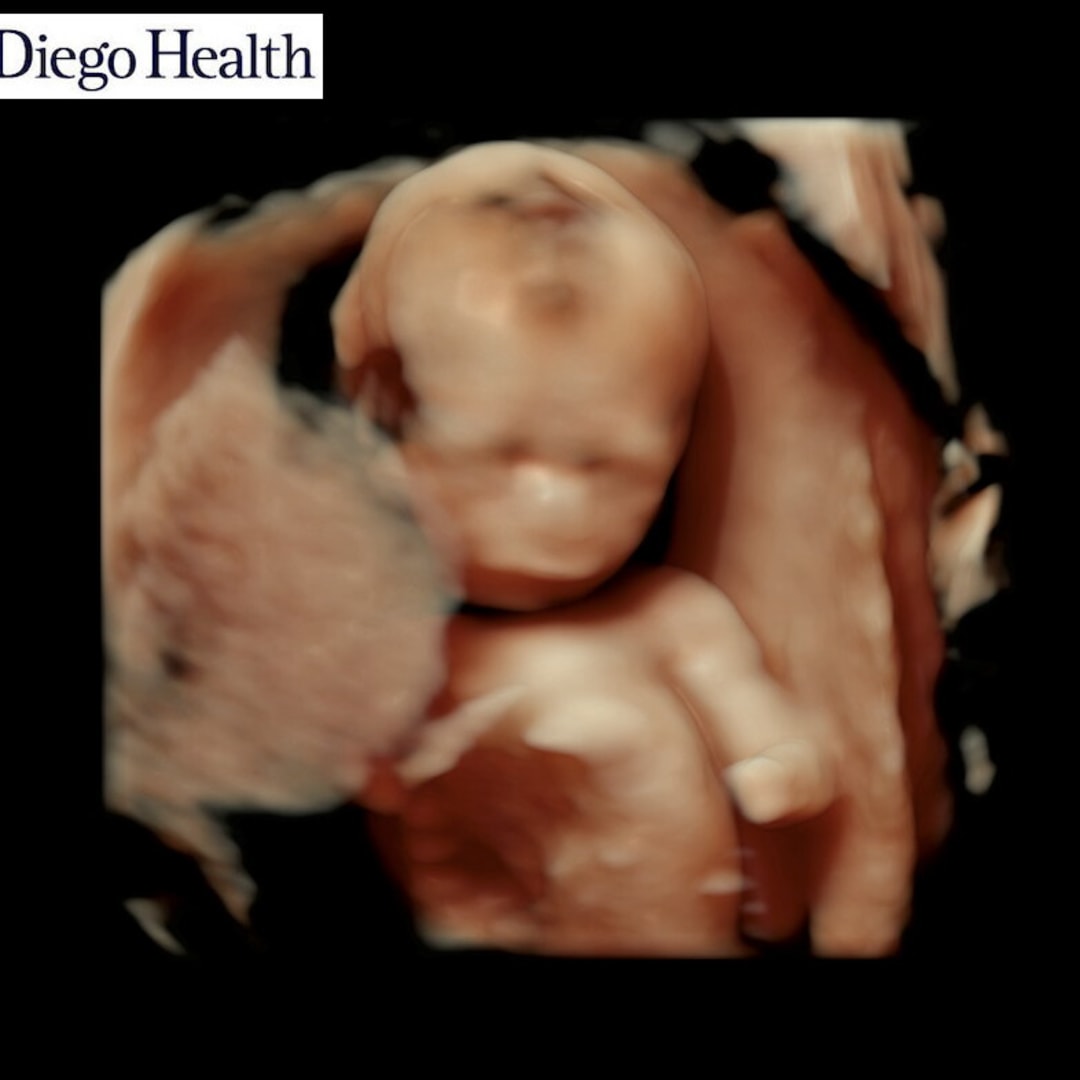 Photo shared by Casey for their Babylist baby registry.