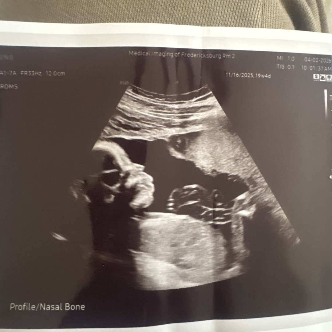 Photo shared by Assie for their Babylist baby registry.