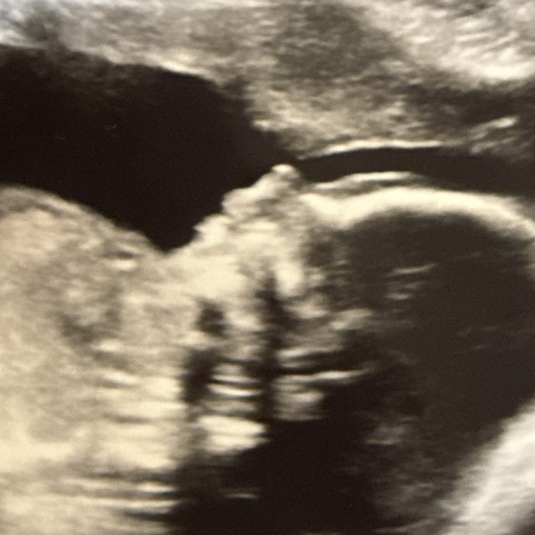 Photo shared by Lauren for their Babylist baby registry.