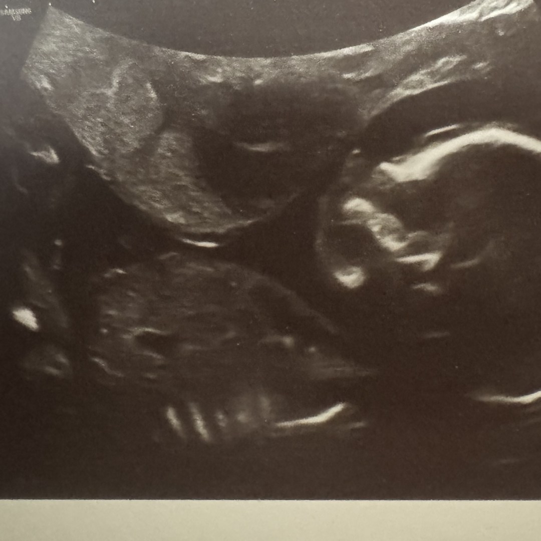 Photo shared by Jessica for their Babylist baby registry.