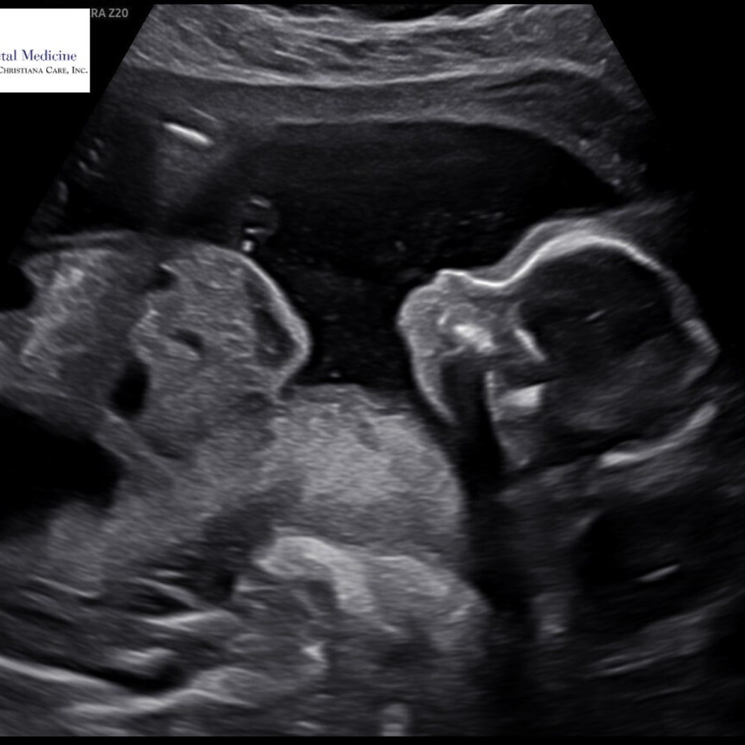 Photo shared by Erica for their Babylist baby registry.