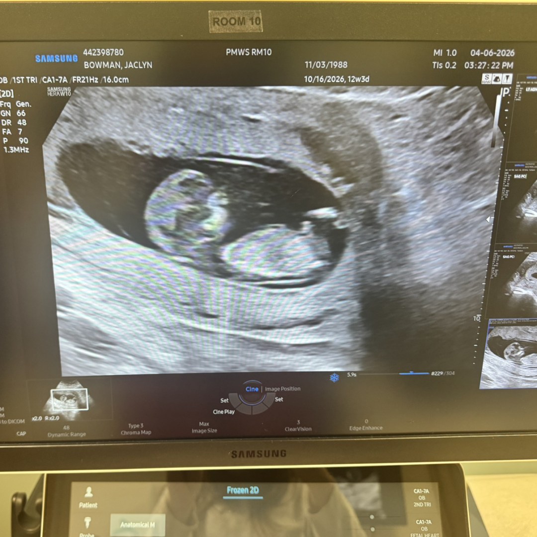 Photo shared by Jackie for their Babylist baby registry.