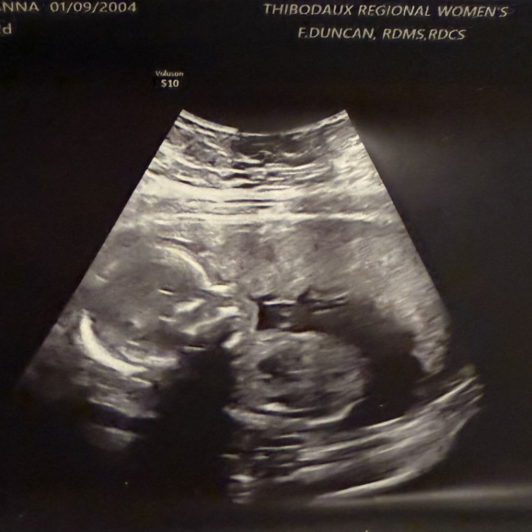 Photo shared by Breanna for their Babylist baby registry.