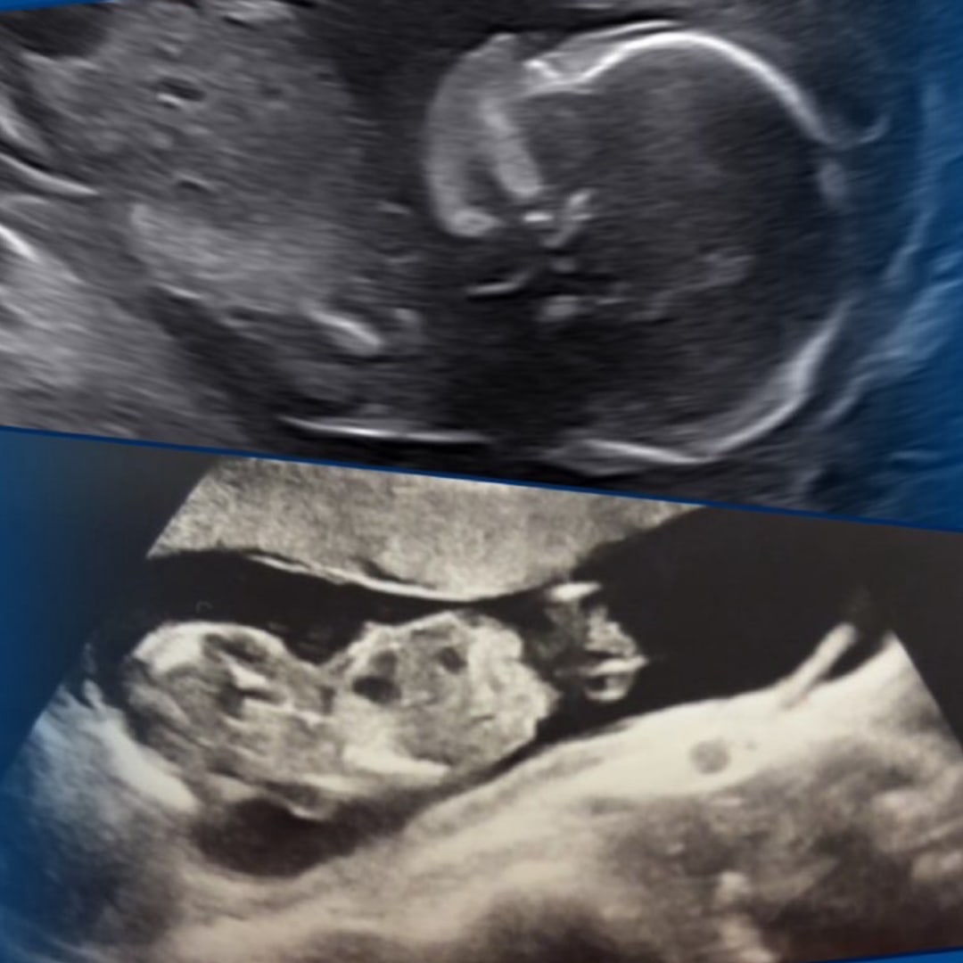 Photo shared by Gracie for their Babylist baby registry.
