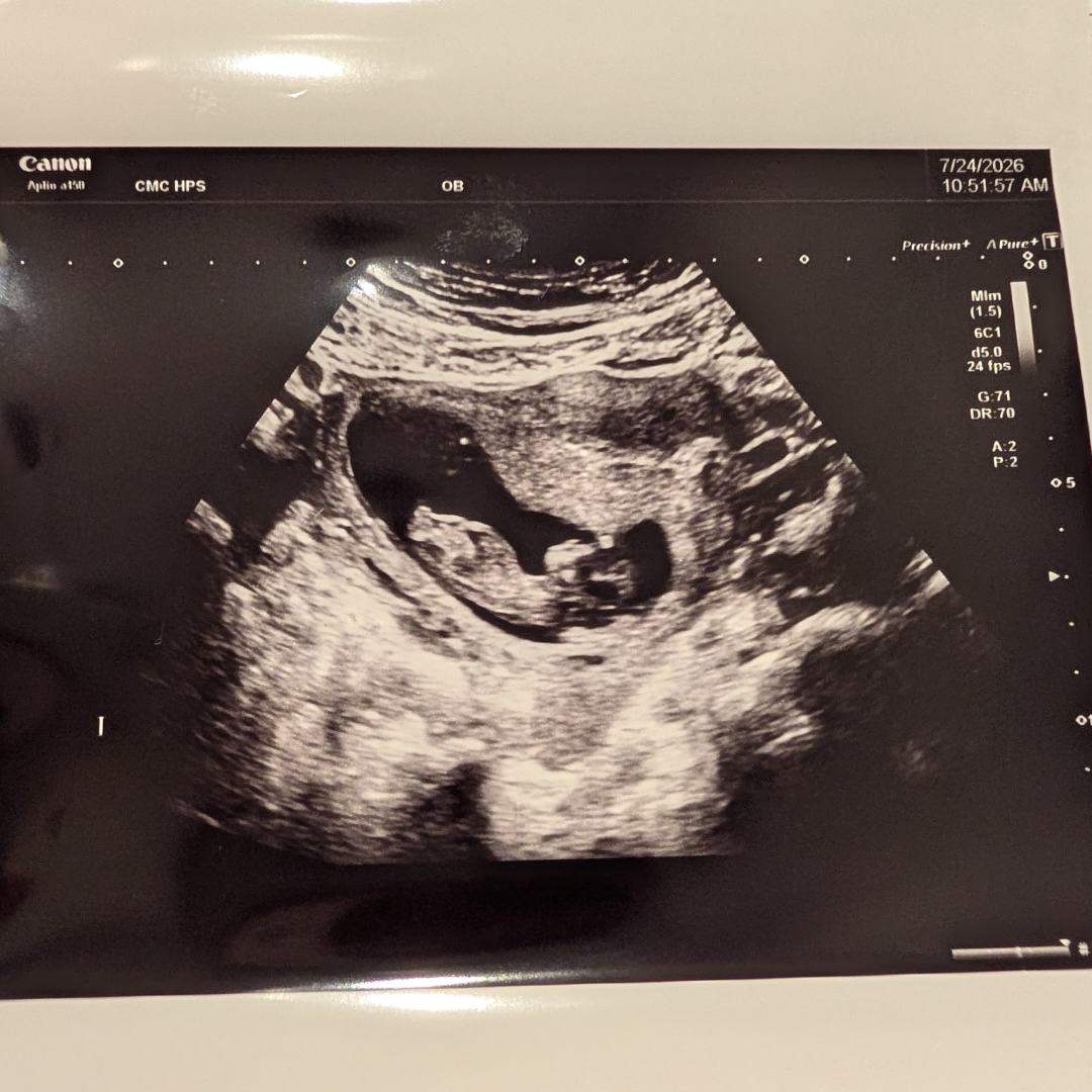 Photo shared by Emily for their Babylist baby registry.