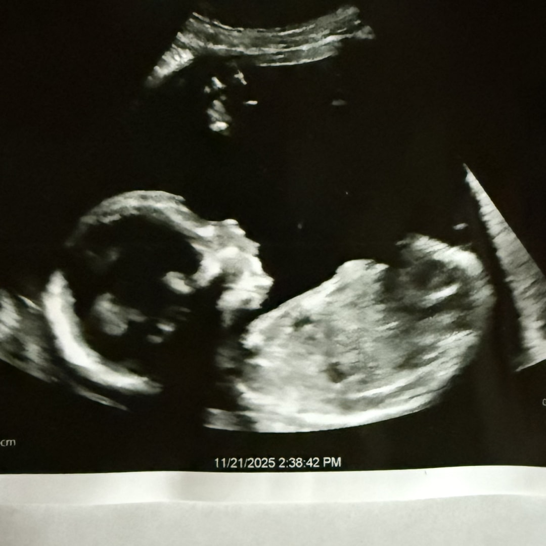 Photo shared by Lauren for their Babylist baby registry.