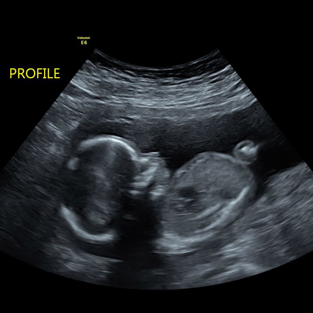 Photo shared by Yasmyne for their Babylist baby registry.