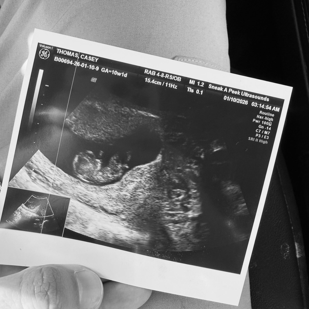Photo shared by Casey for their Babylist baby registry.