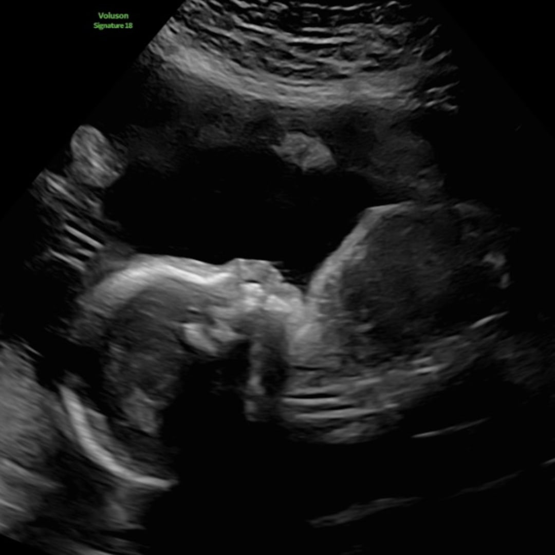 Photo shared by Linsey for their Babylist baby registry.