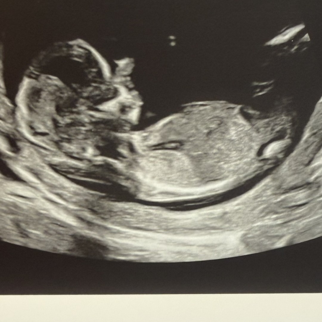 Photo shared by Caitlyn for their Babylist baby registry.