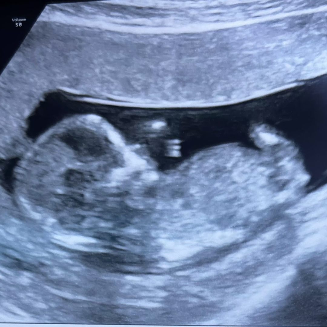 Photo shared by Amber for their Babylist baby registry.