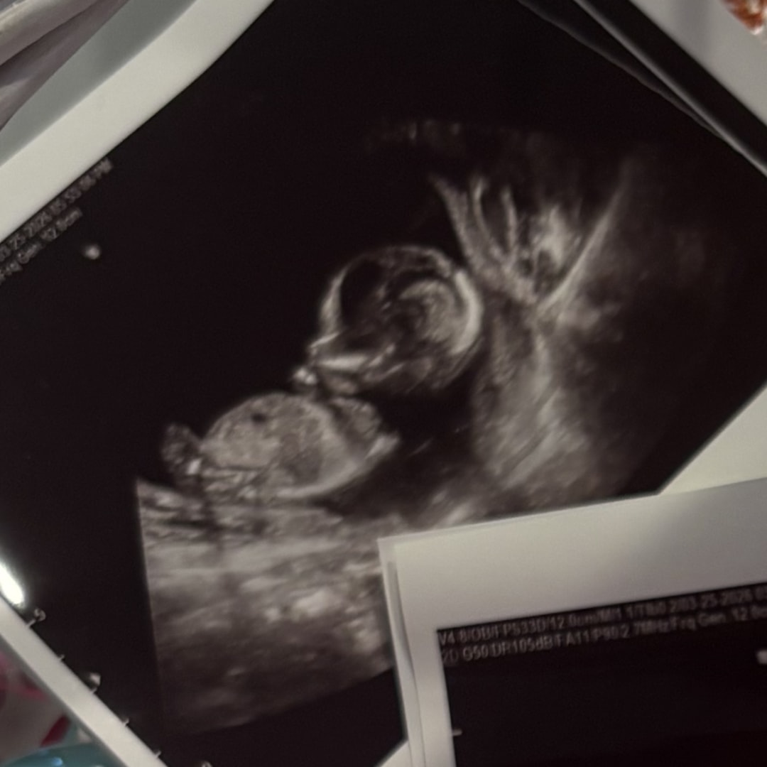 Photo shared by Gaby for their Babylist baby registry.