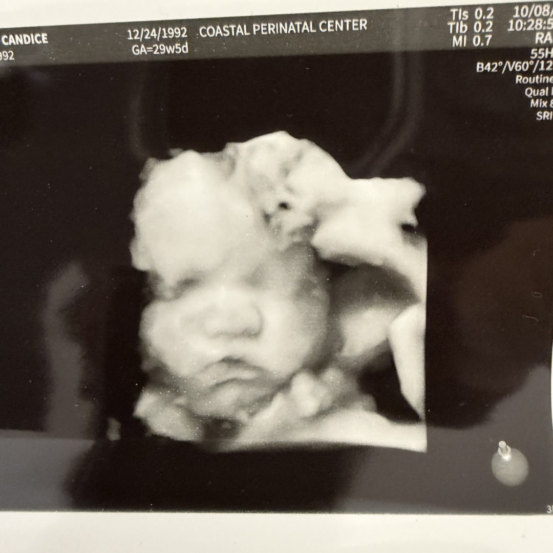 Photo shared by Candice for their Babylist baby registry.