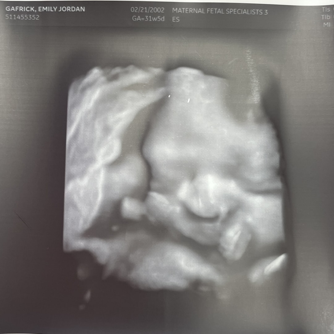 Photo shared by Emily for their Babylist baby registry.