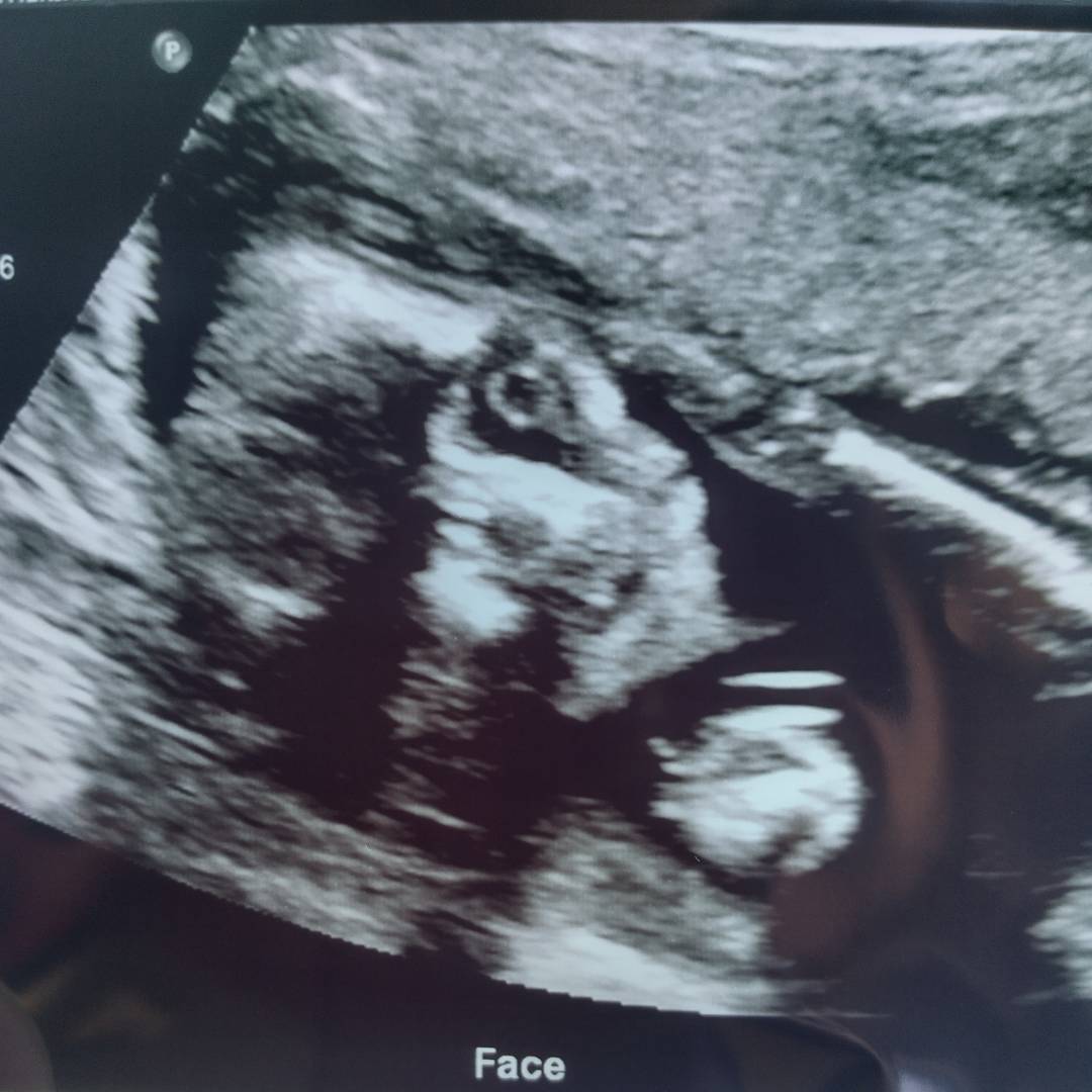 Photo shared by Catherine for their Babylist baby registry.