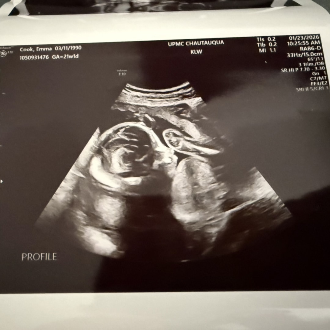 Photo shared by Emma for their Babylist baby registry.