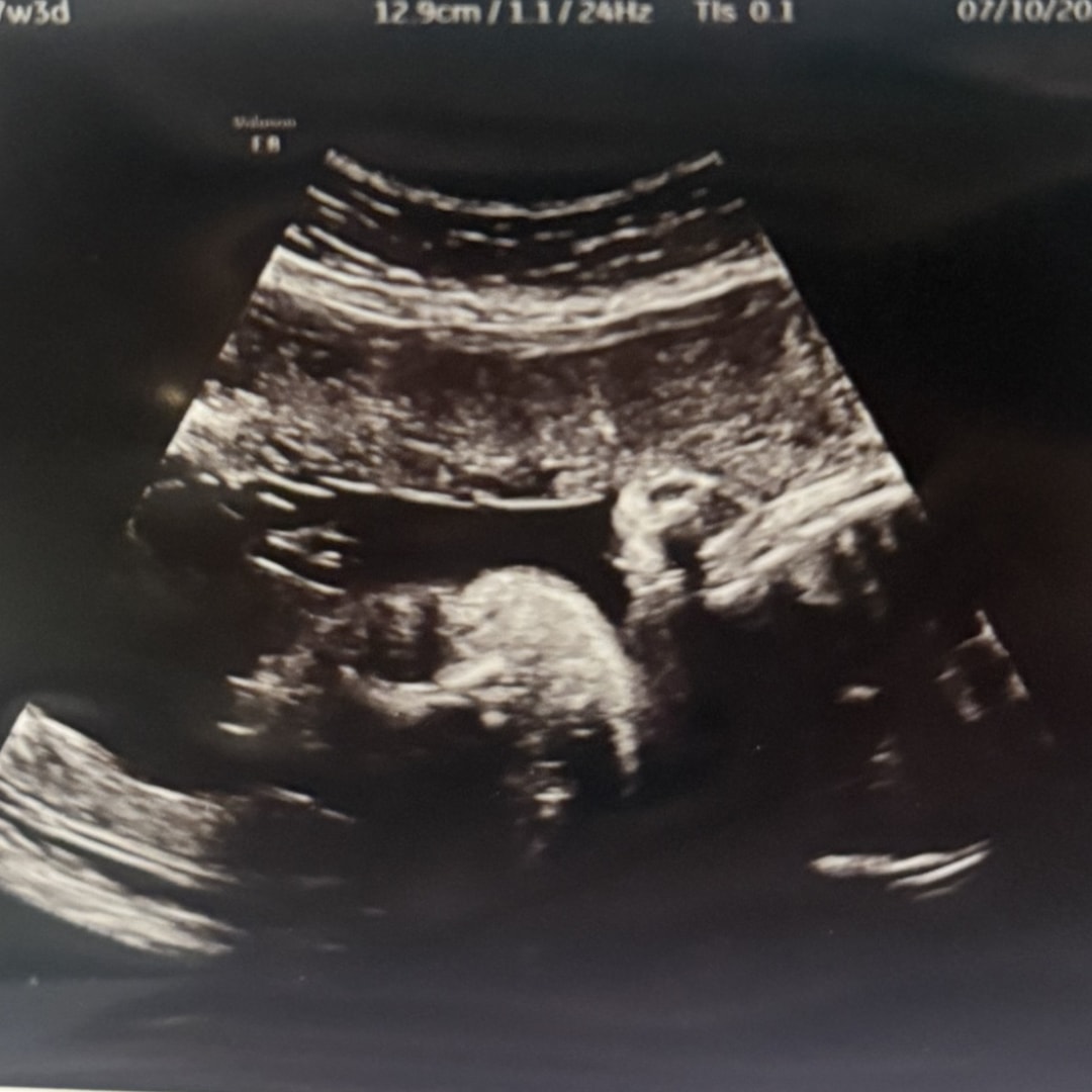 Photo shared by Alexis for their Babylist baby registry.