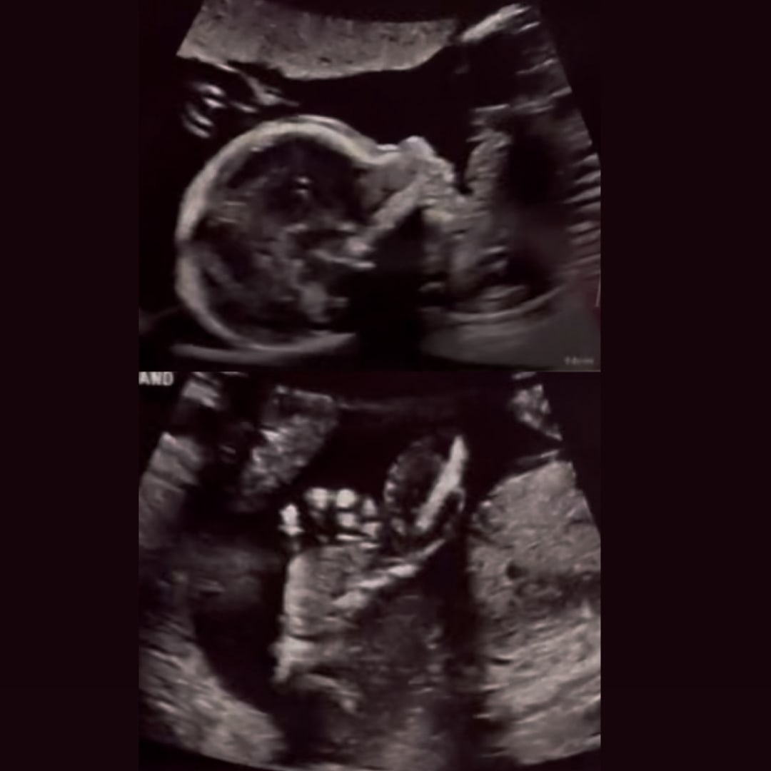 Photo shared by Ava for their Babylist baby registry.