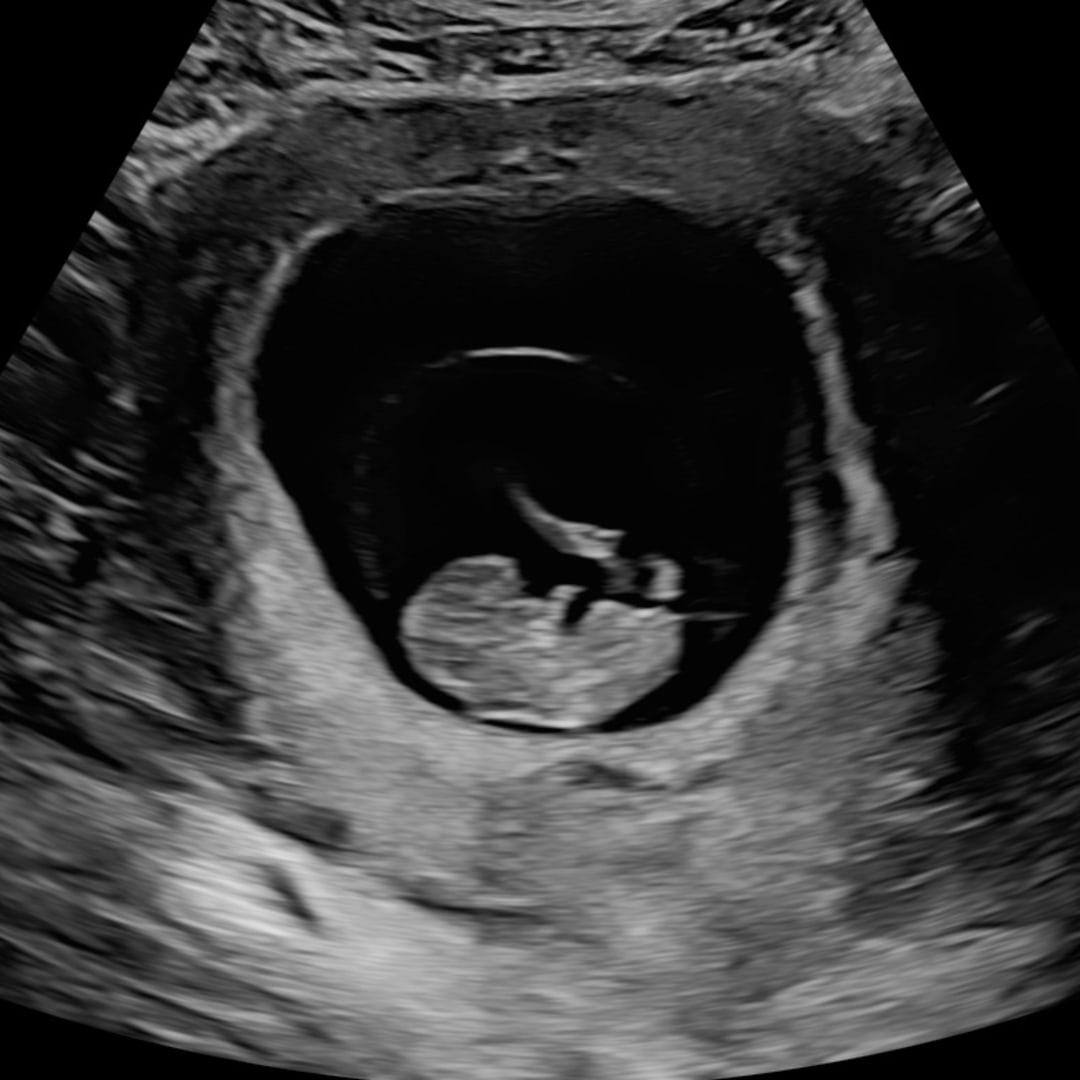 Photo shared by Autumn for their Babylist baby registry.