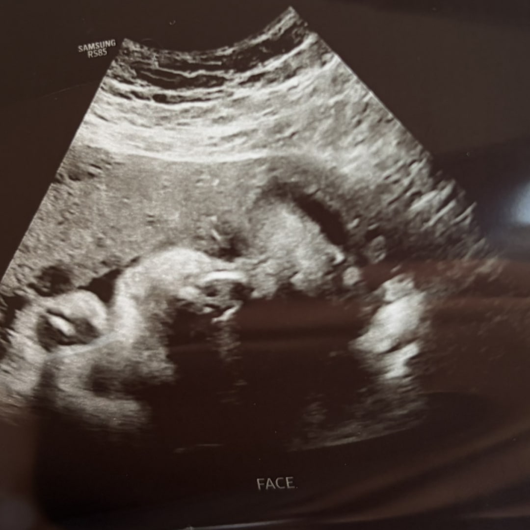 Photo shared by Yudit for their Babylist baby registry.