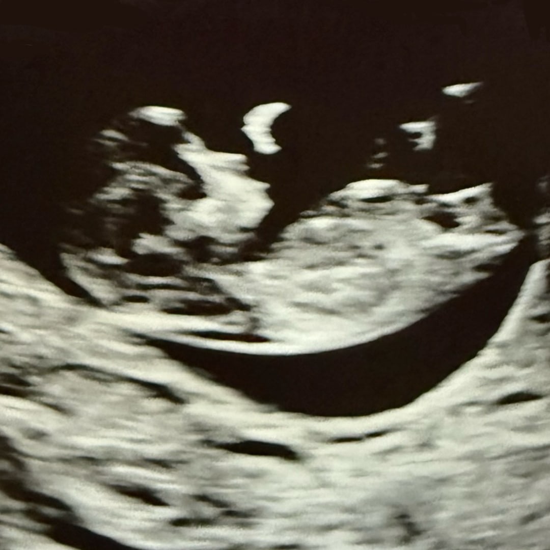 Photo shared by Bethany for their Babylist baby registry.