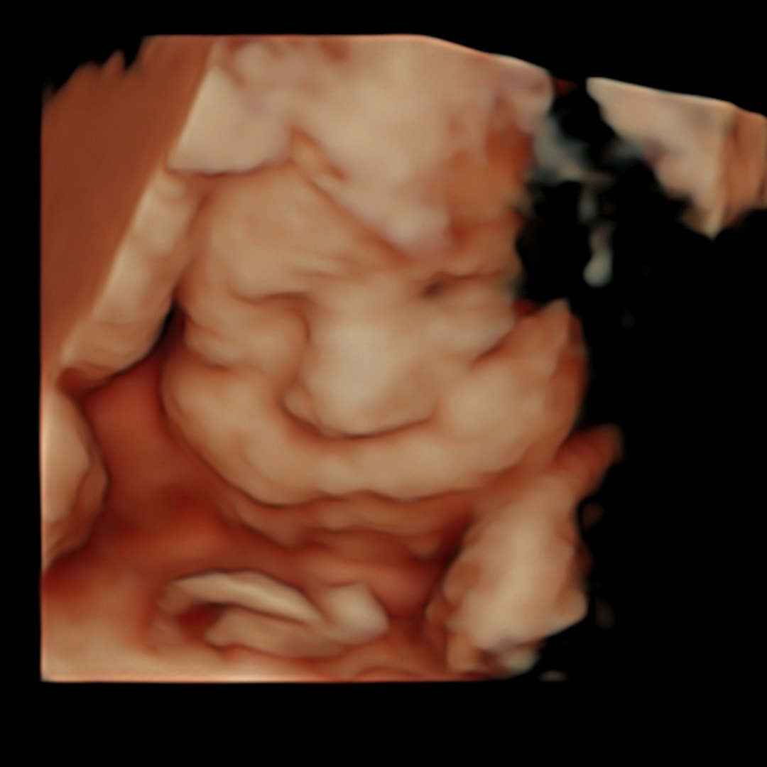 Photo shared by Kimberly for their Babylist baby registry.