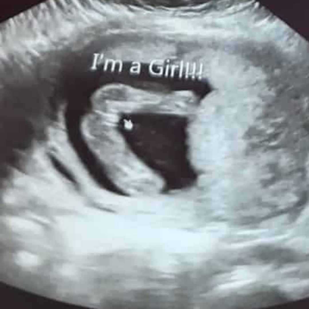 Photo shared by Adrienne for their Babylist baby registry.