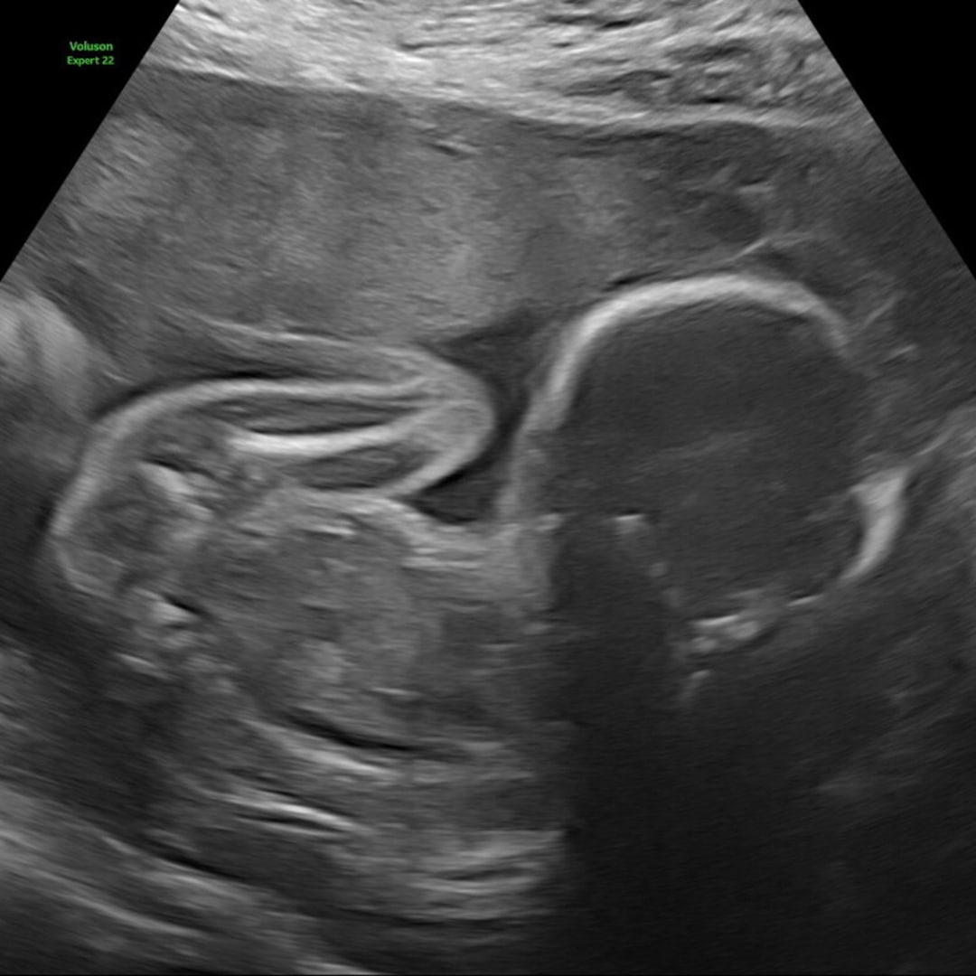Photo shared by Jacklyn for their Babylist baby registry.