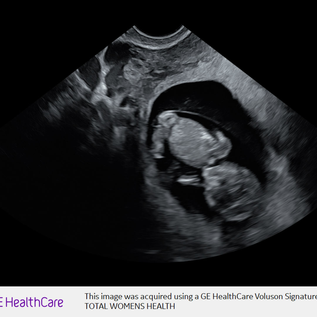 Photo shared by Charde for their Babylist baby registry.