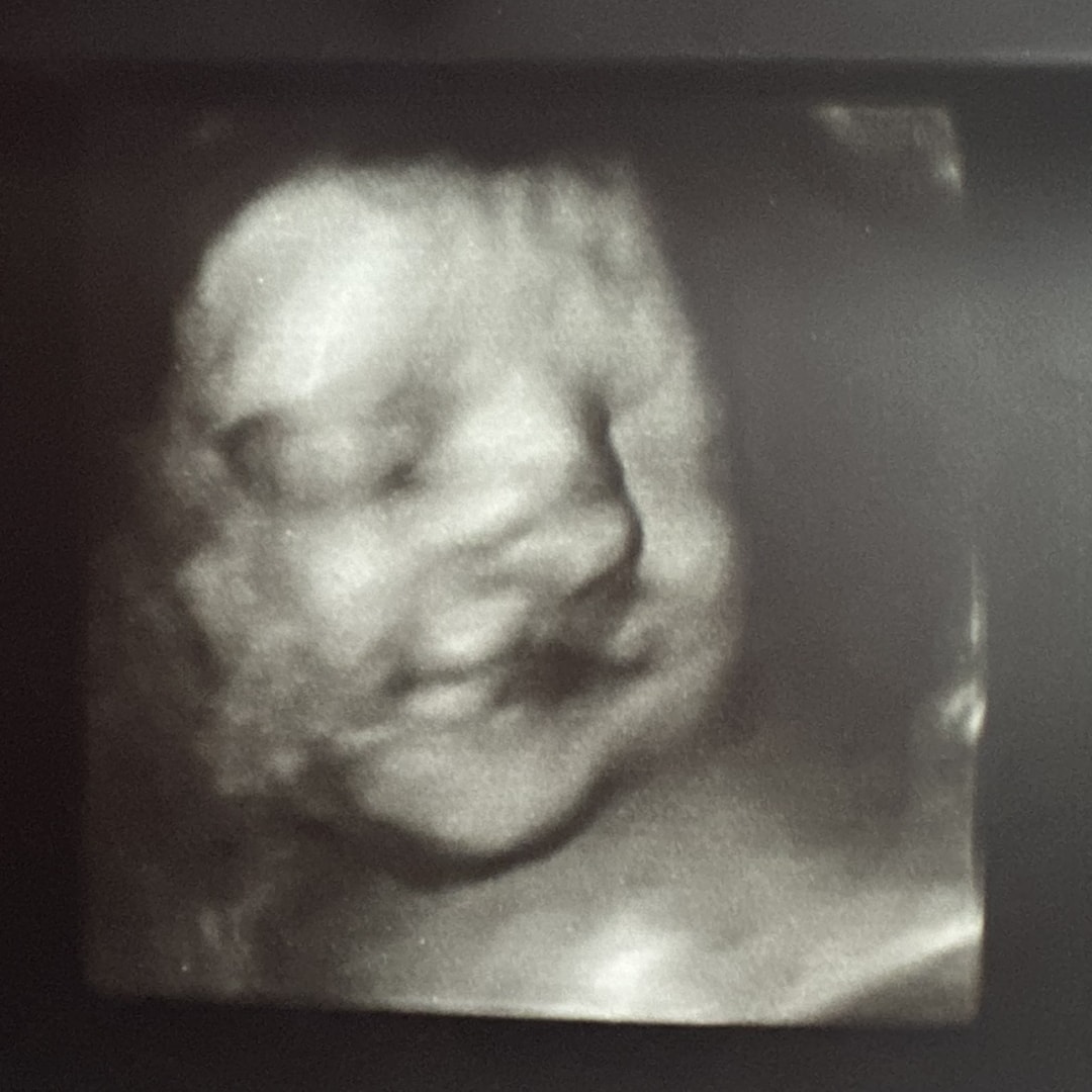 Photo shared by Kaitlyn for their Babylist baby registry.
