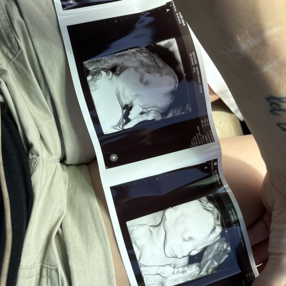 Photo shared by Hailie for their Babylist baby registry.
