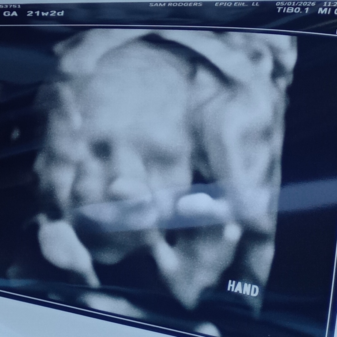 Photo shared by Sabrina for their Babylist baby registry.