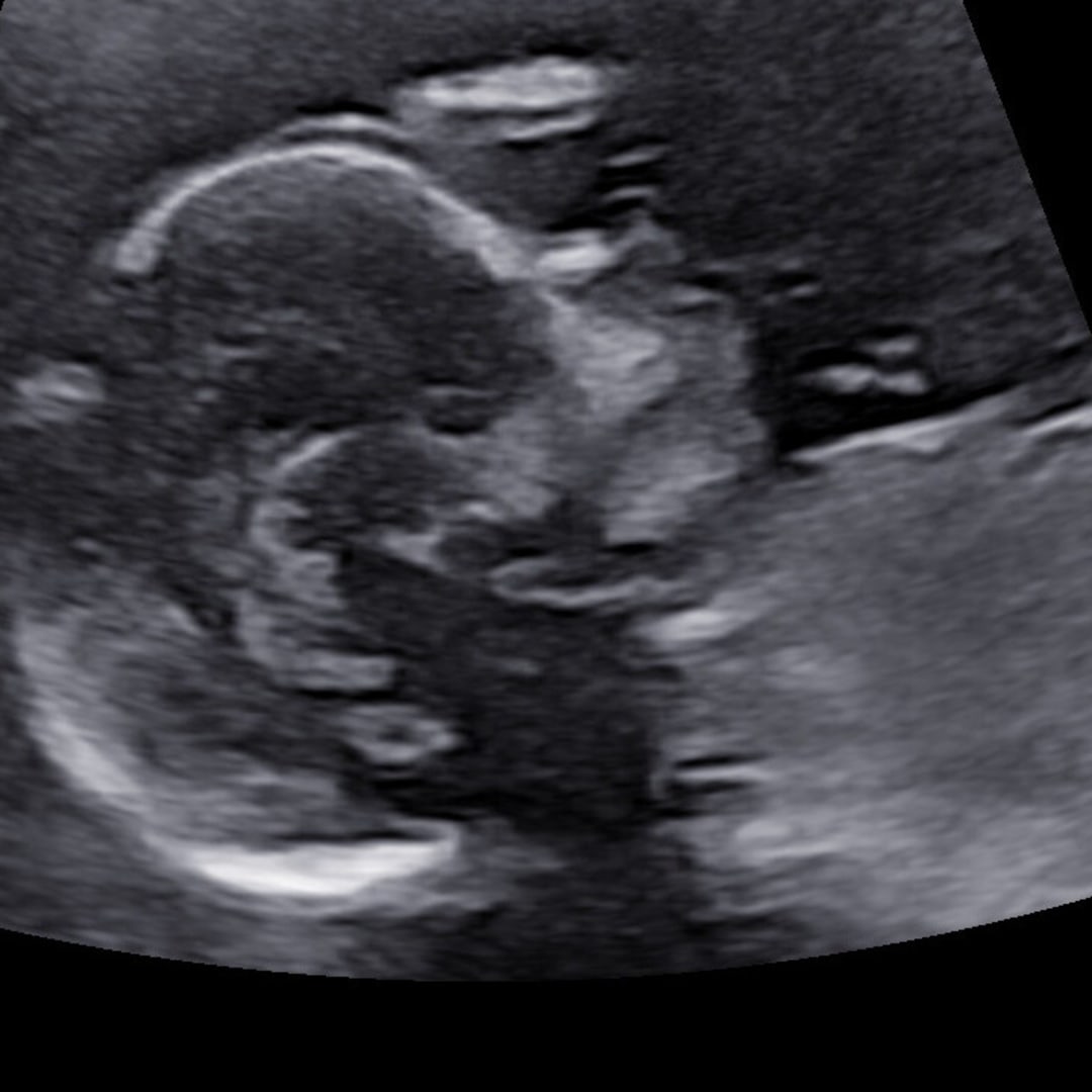 Photo shared by Blair for their Babylist baby registry.