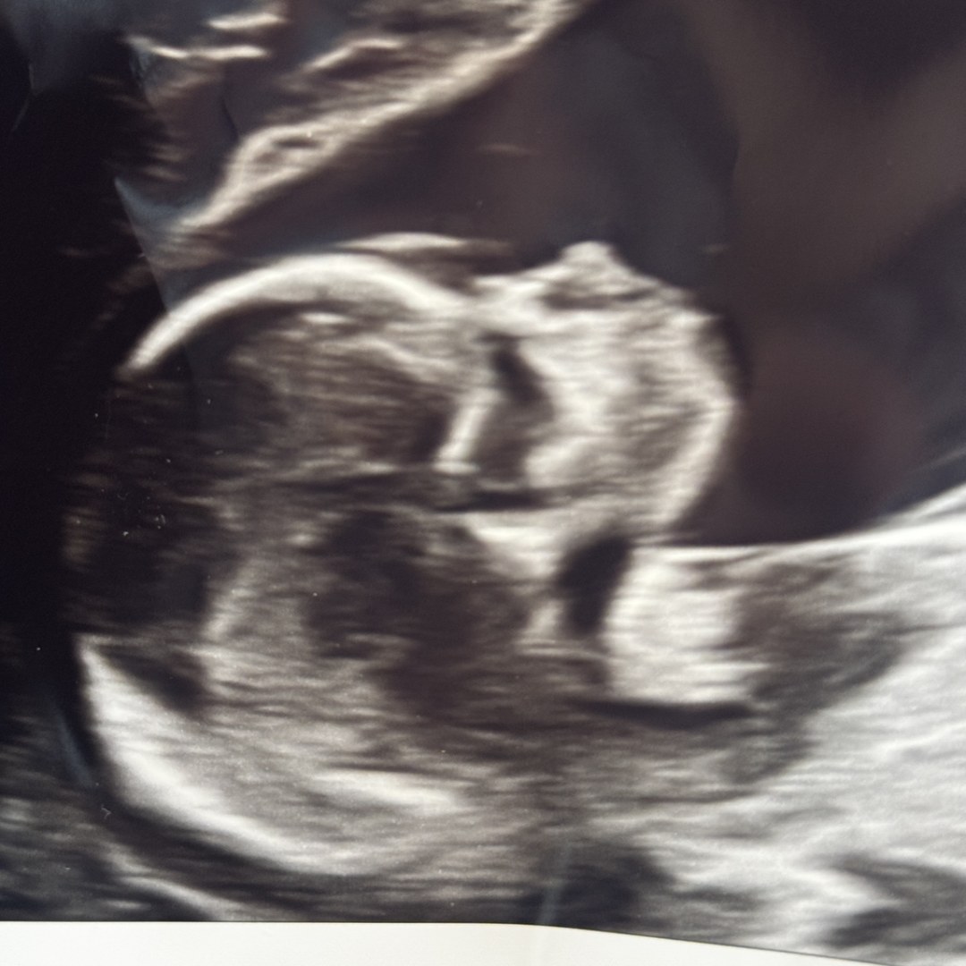 Photo shared by Keysha for their Babylist baby registry.